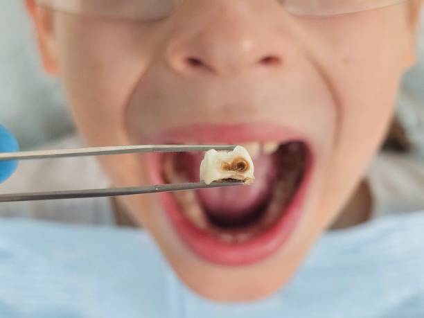 Best Walk-In Emergency Dentist in Thermalito, CA